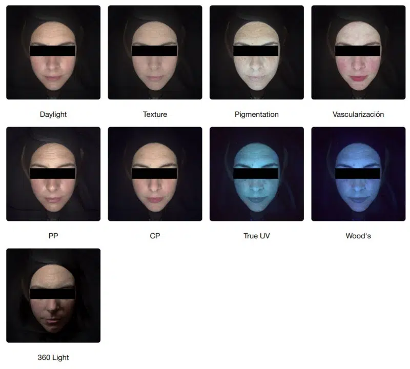 diagnostico-facial-observ-520x-1.jpg